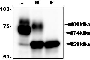 Western Blotting (WB) image for anti-HHV6 gQ1 (AA 3-422) antibody (ABIN2452012) (HHV6 gQ1 (AA 3-422) anticorps)