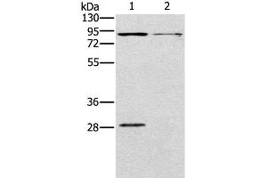 Western Blot analysis of Mouse kidney and brain tissue using CNGA3 Polyclonal Antibody at dilution of 1:500 (CNGA3 anticorps)
