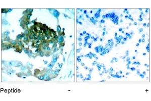 Image no. 1 for anti-Protein Kinase C, theta (PRKCQ) (AA 693-697) antibody (ABIN197401) (PKC theta anticorps  (AA 693-697))
