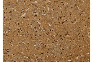 ABIN6269010 at 1/100 staining Rat brain tissue by IHC-P.