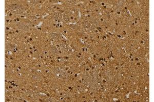 ABIN6269010 at 1/100 staining Rat brain tissue by IHC-P. (HSPA9 anticorps  (C-Term))