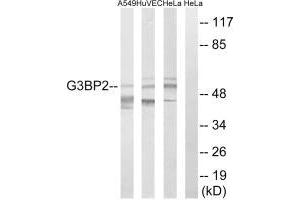 Western blot analysis of extracts from A549 cells, HUVEC cells and HeLa cells, using G3BP2 antibody. (G3BP2 anticorps  (C-Term))