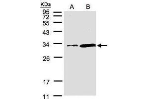 WB Image Sample(30 μg of whole cell lysate) A:Hep G2, B:MOLT4, 12% SDS PAGE antibody diluted at 1:1500 (PITPNA anticorps  (C-Term))