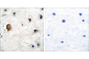 Peptide - +Immunohistochemical analysis of paraffin-embedded human brain tissue using Connexin 43 antibody. (Connexin 43/GJA1 anticorps)