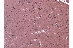 (ABIN263162) (8 μg/mL) staining of paraffin embedded Human Cortex. (DHX58 anticorps  (C-Term))