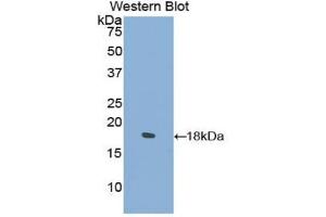 Western blot analysis of the recombinant protein. (COL2A1 anticorps  (AA 677-817))