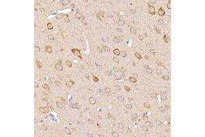 Immunohistochemistry of paraffin-embedded mouse brain using [KO Validated] TR Rabbit pAb (ABIN3021164, ABIN3021165, ABIN3021166 and ABIN1513640) at dilution of 1:250 (40x lens). (TRAF2 anticorps  (AA 1-300))