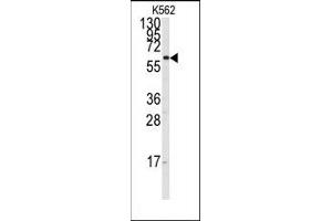Image no. 1 for anti-Cytochrome P450, Family 17, Subfamily A, Polypeptide 1 (CYP17A1) (Middle Region) antibody (ABIN360245) (CYP17A1 anticorps  (Middle Region))