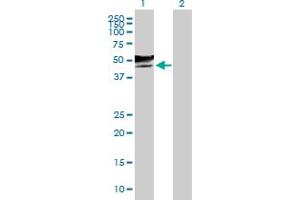 Western Blot analysis of GCNT2 expression in transfected 293T cell line by GCNT2 MaxPab polyclonal antibody. (GCNT2 anticorps  (AA 1-402))
