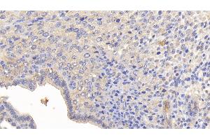 Detection of MMP13 in Mouse Uterus Tissue using Polyclonal Antibody to Matrix Metalloproteinase 13 (MMP13)