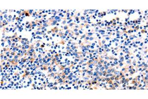 Immunohistochemistry of paraffin-embedded Human tonsil tissue using GADD45 gamma Polyclonal Antibody at dilution 1:120 (GADD45G anticorps)