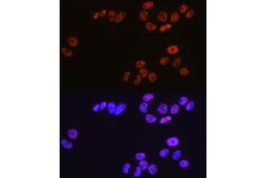 Immunofluorescence analysis of HeLa cells using MCM3 Rabbit mAb (ABIN7268540) at dilution of 1:100 (40x lens).