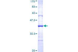 Matrix Metallopeptidase 26 (MMP26) (AA 152-261) protein (GST tag)