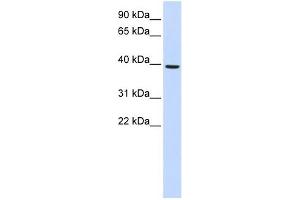 MOGAT2 antibody used at 1 ug/ml to detect target protein. (MOGAT2 anticorps  (Middle Region))