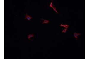 ABIN6269325 staining HeLa cells by IF/ICC.