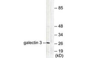Western blot analysis of extracts from HeLa cells, using Galectin 3 Antibody. (Galectin 3 anticorps  (AA 141-190))