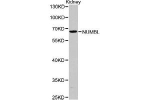 Western blot analysis of extracts of Kidney cells, using NUMBL antibody (ABIN5971167). (NUMBL anticorps)