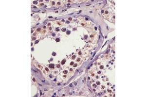 (ABIN6241064 and ABIN6578961) staining IRAK1 in human testis tissue sections by Immunohistochemistry (IHC-P - paraformaldehyde-fixed, paraffin-embedded sections).
