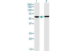 Western Blot analysis of PPP2R5D expression in transfected 293T cell line by PPP2R5D monoclonal antibody (M01), clone 4E12. (PPP2R5D anticorps  (AA 1-602))