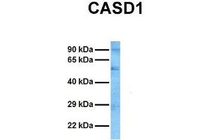 Host:  Rabbit  Target Name:  CASD1  Sample Tissue:  Human HT1080  Antibody Dilution:  1. (CASD1 anticorps  (N-Term))