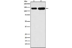 Western blot analysis of K Cadherin expression in (1) Jurkat cell lysate, (2) Mouse heart lysate.