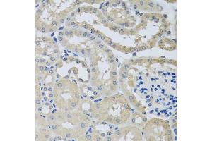 Immunohistochemistry of paraffin-embedded mouse kidney using CHMP1B antibody (ABIN5974811) at dilution of 1/100 (40x lens). (CHMP1B anticorps)