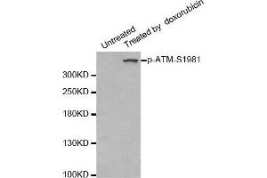 Western blot analysis of extracts of 293 cells, using phospho-ATM-S1981 antibody. (ATM anticorps  (pSer1981))