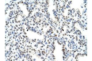 WDR6 antibody was used for immunohistochemistry at a concentration of 4-8 ug/ml to stain Alveolar cells (arrows) in Human Lung. (WDR6 anticorps  (C-Term))