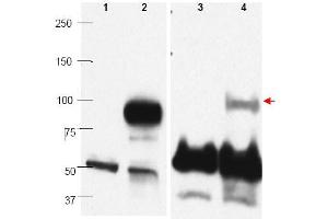 Image no. 1 for anti-PR Domain Containing 1, with ZNF Domain (PRDM1) (C-Term) antibody (ABIN401477) (PRDM1 anticorps  (C-Term))