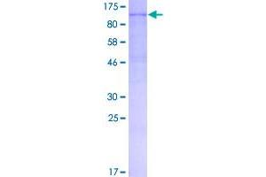 SDS-PAGE (SDS) image for Ectonucleotide Pyrophosphatase/phosphodiesterase 1 (ENPP1) (AA 1-873) protein (GST tag) (ABIN1782407)