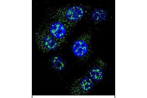 Confocal immunofluorescent analysis of MGMT Antibody (N-term) (ABIN657769 and ABIN2846745) with MCF-7 cell followed by Alexa Fluor 488-conjugated goat anti-rabbit lgG (green).