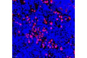 Immunofluorescence of paraffin embedded mouse spleen using ANXA3 (ABIN7073065) at dilution of 1: 300 (400x lens)