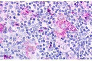 anti-Chemokine-Like Receptor 1 (CMKLR1) (N-Term) antibody