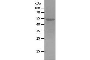 Western Blotting (WB) image for Reticulon 3 (RTN3) (AA 128-358) protein (His-IF2DI Tag) (ABIN7124837)