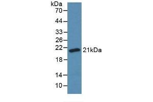Detection of Recombinant SOD1, Bovine using Monoclonal Antibody to Superoxide Dismutase 1 (SOD1) (SOD1 anticorps  (AA 2-152))