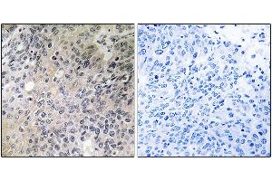 Immunohistochemistry analysis of paraffin-embedded human lung tissue using SHC3 antibody. (SHC3 anticorps)