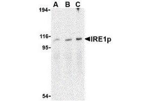 Western Blotting (WB) image for anti-Endoplasmic Reticulum To Nucleus Signaling 1 (ERN1) (C-Term) antibody (ABIN2475138) (ERN1 anticorps  (C-Term))