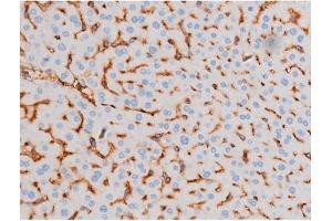 ABIN6267486 at 1/200 staining Mouse liver tissue sections by IHC-P.