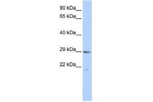 MORF4 antibody used at 0. (MORF4 anticorps  (Middle Region))