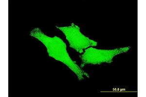 Immunofluorescence of monoclonal antibody to ERBB2 on HeLa cell.