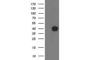 Western Blotting (WB) image for anti-Retinaldehyde Binding Protein 1 (RLBP1) antibody (ABIN1497625) (RLBP1 anticorps)