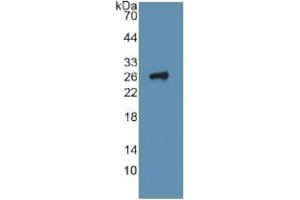 WB of Protein Standard: different control antibodies against Highly purified E. (ITGA2 Kit ELISA)
