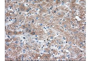 Immunohistochemical staining of paraffin-embedded Human liver tissue using anti-TBXAS1 mouse monoclonal antibody. (TBXAS1 anticorps)