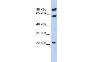 WB Suggested Anti-TIGD3 Antibody Titration:  0. (TIGD3 anticorps  (Middle Region))