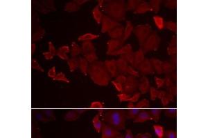 Immunofluorescence analysis of U2OS cells using MARCKSL1 Polyclonal Antibody (MARCKSL1 anticorps)