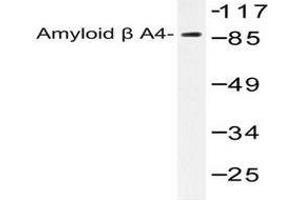 Image no. 1 for anti-Amyloid beta (A4) Precursor Protein (APP) antibody (ABIN265307) (APP anticorps)