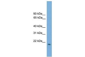 WB Suggested Anti-GPX2  Antibody Titration: 0. (Glutathione Peroxidase 2 anticorps  (Middle Region))