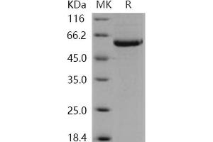 Western Blotting (WB) image for serine/threonine Kinase 4 (STK4) (Active) protein (His tag) (ABIN7317074)