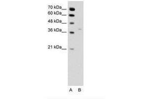 Image no. 2 for anti-Hydroxysteroid (17-Beta) Dehydrogenase 1 (HSD17B1) (N-Term) antibody (ABIN6736344) (HSD17B1 anticorps  (N-Term))