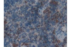 Detection of MPO in Rat Spleen Tissue using Polyclonal Antibody to Myeloperoxidase (MPO)